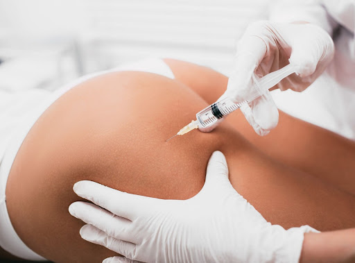 Bioestimulação de colagénio – GoldIncision
